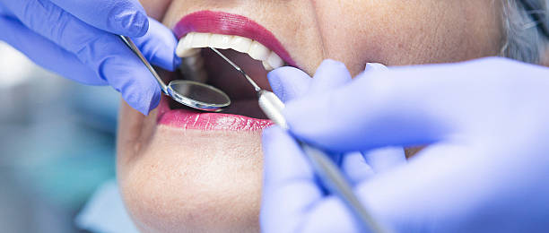 Best Emergency Dentist for Lost Fillings or Crowns in Evans, CO